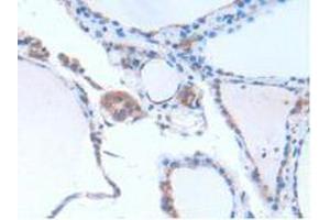 IHC-P analysis of Human Thyroid Tissue, with DAB staining. (GNB1L antibody  (AA 69-247))
