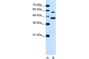 WB Suggested Anti-SLC39A5 Antibody Titration:  0.