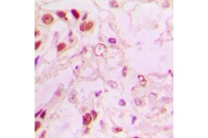 Immunohistochemistry (IHC) image for anti-Mdm2, p53 E3 Ubiquitin Protein Ligase Homolog (Mouse) (MDM2) (C-Term) antibody (ABIN7296282)