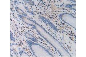 IHC-P analysis of Human Stomach Tissue, with DAB staining. (PZP antibody  (AA 1212-1391))