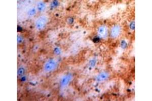 Used in DAB staining on fromalin fixed paraffin-embedded brain tissue (S100 Protein (S100) (AA 1-94) antibody)