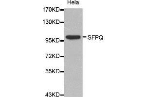 Western Blotting (WB) image for anti-Splicing Factor Proline/glutamine-Ric (SFPQ) (AA 578-707) antibody (ABIN1513519) (SFPQ antibody  (AA 578-707))