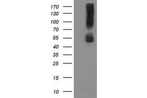 Image no. 2 for anti-Sequestosome 1 (SQSTM1) antibody (ABIN1499987) (SQSTM1 antibody)