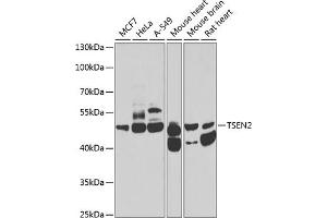 Western blot analysis of extracts of various cell lines, using TSEN2 antibody (ABIN6131375, ABIN6149615, ABIN6149616 and ABIN6223809) at 1:1000 dilution. (TSEN2 antibody  (AA 1-220))