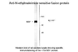 Western blot of Anti-NSF (N-ethylmaleimide sensitive fusion protein) (Rabbit) Antibody - 612-401-E01 Western Blot of Rabbit anti-NSF (N-ethylmaleimide sensitive fusion protein) antibody.