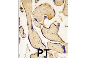 Formalin-fixed and paraffin-embedded human placenta tissue reacted with EphA3 antibody (C-term ), which was peroxidase-conjugated to the secondary antibody, followed by DAB staining. (EPH Receptor A3 antibody  (C-Term))