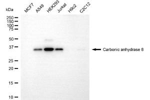 Western blotting analysis using carbonic anhydrase 8 antibody (ABIN7797870).
