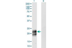 Western Blot analysis of TNFRSF17 expression in transfected 293T cell line by TNFRSF17 monoclonal antibody (M06), clone 3H6. (BCMA antibody  (AA 1-184))