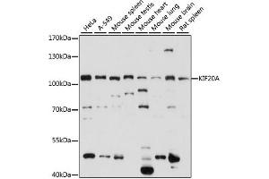 Western blot analysis of extracts of various cell lines, using KIF20A antibody (ABIN7268125) at 1:1000 dilution. (KIF20A antibody  (AA 591-890))