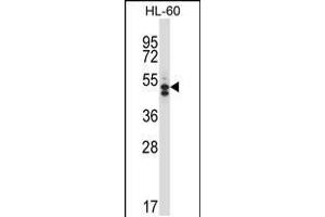 Western blot analysis in HL-60 cell line lysates (35ug/lane). (HDAC7 antibody  (C-Term))