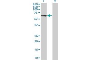 Western Blot analysis of STK33 expression in transfected 293T cell line by STK33 MaxPab polyclonal antibody. (STK33 antibody  (AA 1-514))