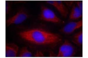 Image no. 2 for anti-Phospholipase C gamma 2 (PLCG2) (Tyr1217) antibody (ABIN319402) (Phospholipase C gamma 2 antibody  (Tyr1217))