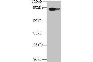 Western blot All lanes: JUP antibody at 2 μg/mL + A431 whole cell lysate Secondary Goat polyclonal to rabbit IgG at 1/10000 dilution Predicted band size: 82 kDa Observed band size: 82 kDa (JUP antibody  (AA 1-131))