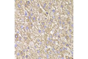 Immunohistochemistry of paraffin-embedded human liver injury using CIAPIN1 Antibody (ABIN1980352) at dilution of 1:100 (40x lens).