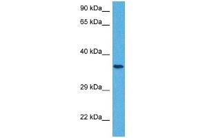 Host:  Rabbit  Target Name:  SLC25A32  Sample Tissue:  Human Jurkat Whole Cell  Antibody Dilution:  1ug/ml (SLC25A32 antibody  (N-Term))