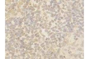 Image no. 1 for anti-Cullin 4B (CUL4B) antibody (ABIN1502456) (Cullin 4B antibody)
