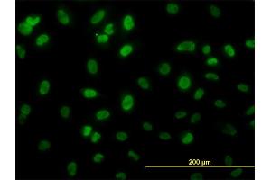 Immunofluorescence of monoclonal antibody to HSGT1 on HeLa cell. (ECD/SGT1 antibody  (AA 1-644))