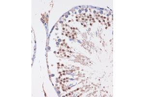 Immunohistochemistry of paraffin-embedded Rat testis using LYAR Rabbit pAb  at dilution of 1:100 (40x lens). (LYAR antibody  (AA 10-160))