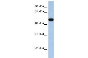 WB Suggested Anti-SLC25A46  Antibody Titration: 0. (SLC25A46 antibody  (C-Term))