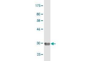 Western Blot detection against Immunogen (33. (EMR4P antibody  (AA 21-93))
