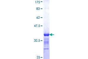Image no. 1 for Prickle-Like Protein 1 (PRICKLE1) (AA 684-756) protein (GST tag) (ABIN1316196)