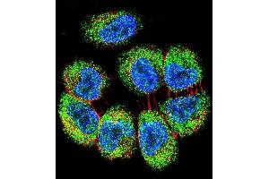 Confocal immunofluorescent analysis of TRIM65 Antibody (Center) (ABIN655759 and ABIN2845202) with NCI- cell followed by Alexa Fluor 488-conjugated goat anti-rabbit lgG (green). (TRIM65 antibody  (AA 327-355))