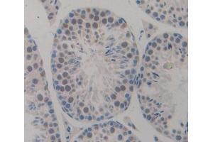 Immunohistochemistry (IHC) image for anti-Cyclin-Dependent Kinase Inhibitor 2D (p19, Inhibits CDK4) (CDKN2D) (AA 1-166) antibody (ABIN7445234)