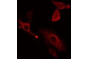 ABIN6277589 staining HeLa cells by IF/ICC. (CBR1 antibody  (C-Term))