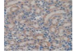 IHC-P analysis of Rat Kidney Tissue, with DAB staining. (GATA4 antibody  (AA 228-440))