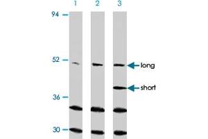 Western blot analysis of CASP2 in Ramos cells with CASP2 polyclonal antibody at (A) 0.