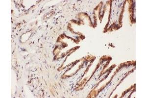 IHC-P: ALOX15 antibody testing of rat lung tissue (ALOX15 antibody  (AA 2-337))