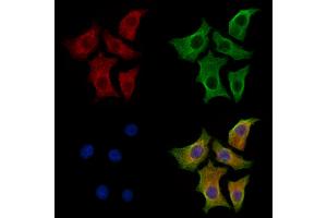 ABIN7094250 and ABIN7098297 staining HepG2 cells by IF/ICC.