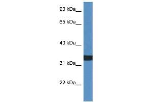 Human HCT15; WB Suggested Anti-ACER1 Antibody. (ACER1 antibody  (C-Term))
