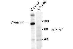 Image no. 1 for anti-Dynamin 1 (DNM1) (pSer774) antibody (ABIN372616)