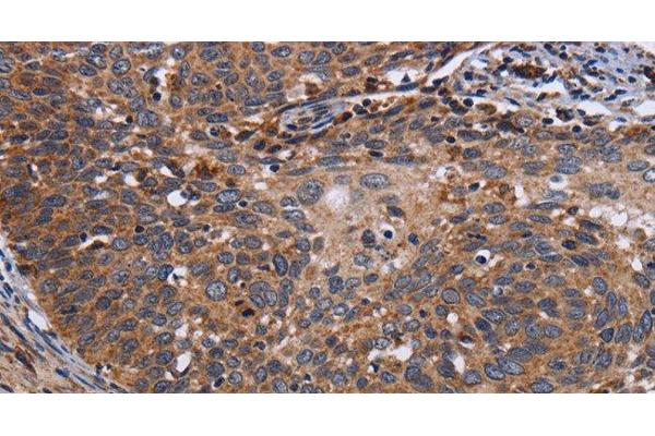 LRRC15 antibody