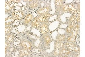 ABIN6258961 and ABIN6274952 at 1/100 staining human normal kidney tissue by IHC-P.