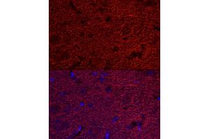 Immunofluorescence analysis of rat brain cells using M Rabbit pAb (ABIN1680751, ABIN3015149, ABIN3015150 and ABIN6213853) at dilution of 1:25 (40x lens). (MAP2 antibody  (AA 260-559))