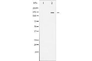 Western Blotting (WB) image for anti-Nitric Oxide Synthase 3 (Endothelial Cell) (NOS3) (pSer1177) antibody (ABIN6256115)