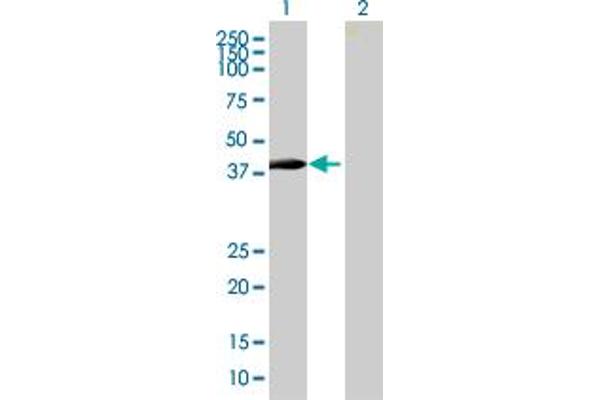 ZNF547 Antikörper  (AA 1-402)
