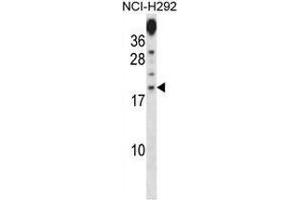 Western blot analysis in NCI-H292 cell line lysates (35ug/lane) using PRR15 Antibody (C-term). (Proline Rich 15 antibody  (C-Term))
