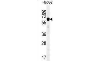 Western Blotting (WB) image for anti-Insulin-Like Growth Factor 2 mRNA Binding Protein 2 (IGF2BP2) antibody (ABIN2995531) (IGF2BP2 antibody)