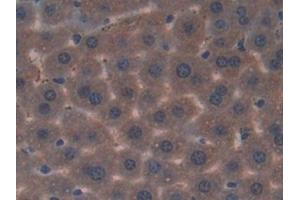 Immunohistochemistry (IHC) image for anti-Adenomatous Polyposis Coli (APC) (AA 2636-2845) antibody (ABIN7439342)
