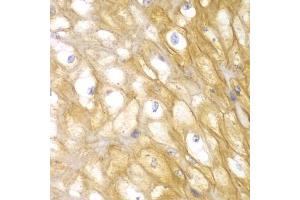 Immunohistochemistry of paraffin-embedded human esophagus using ACTN1 antibody (ABIN5970506) at dilution of 1/100 (40x lens). (ACTN1 antibody)