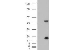 HEK293T cells were transfected with the pCMV6-ENTRY control (Left lane) or pCMV6-ENTRY SHH (RC222175) (Right lane) cDNA for 48 hrs and lysed. (Sonic Hedgehog antibody  (AA 24-197))