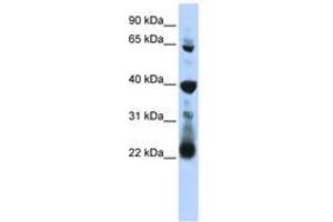 Image no. 1 for anti-RNA Pseudouridylate Synthase Domain Containing 3 (RPUSD3) (AA 251-300) antibody (ABIN6743049) (RPUSD3 antibody  (AA 251-300))