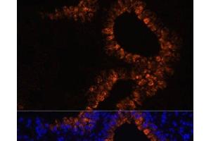 Immunofluorescence analysis of Mouse lung cells using SCGB1A1 Polyclonal Antibody at dilution of 1:100. (SCGB1A1 antibody)