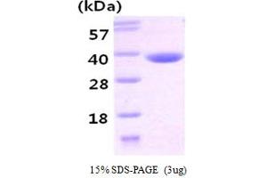 SDS-PAGE (SDS) image for Carbonyl Reductase 3 (CBR3) (AA 1-277) protein (His tag) (ABIN667118) (CBR3 Protein (AA 1-277) (His tag))