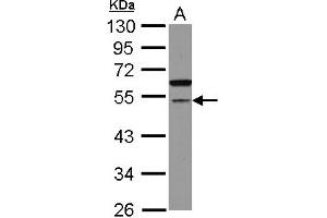 Western Blotting (WB) image for anti-Cell Division Cycle Associated 7-Like (CDCA7L) (AA 184-397) antibody (ABIN1497406) (CDCA7L antibody  (AA 184-397))