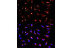Immunofluorescence (IF) image for anti-Glycine Cleavage System H Protein (GCSH) (AA 1-173) antibody (ABIN6141032)