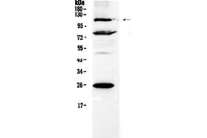 Western blot analysis of NFAT4 using anti-NFAT4 antibody . (NFATC3 antibody  (AA 630-712))